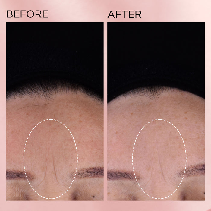 Advanced & Retinol + HPR Capsule Serum Set