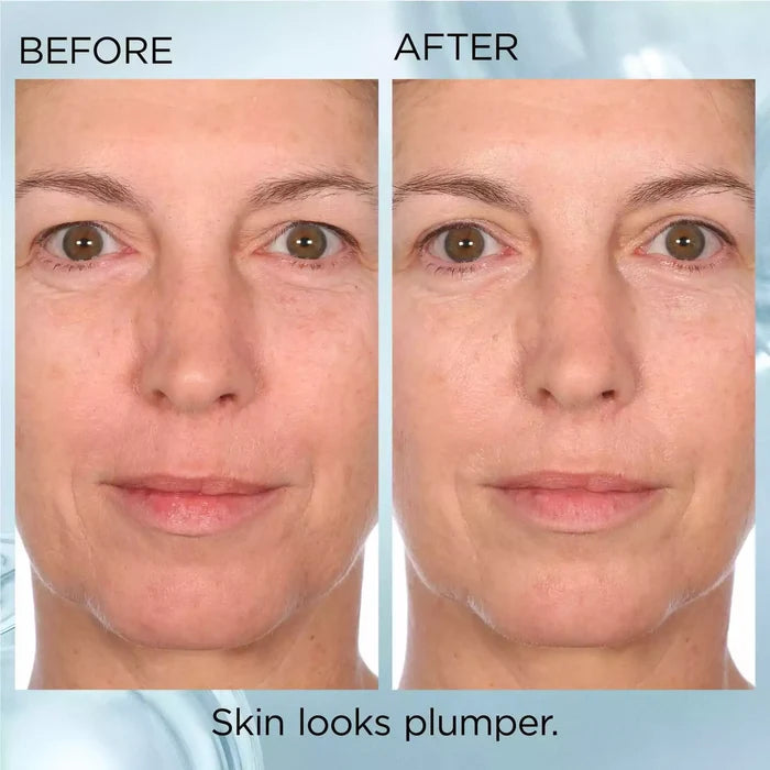 Hyaluronic Acid + Peptides Ceramide Capsules Hydra-Plumping Serum before & after results