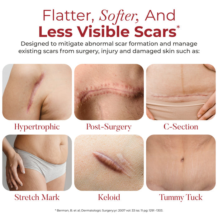 Surgical Scar Tape - HealFast