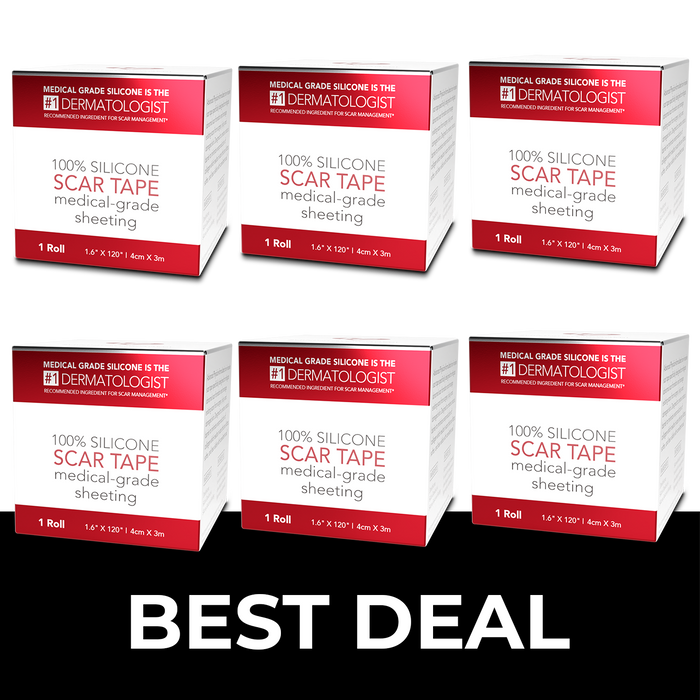 6 Boxes