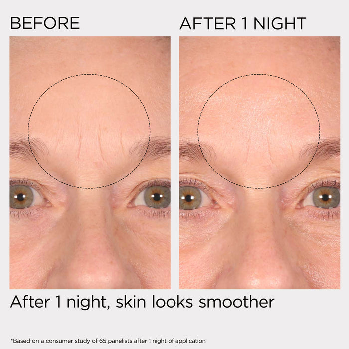 Before and after comparison of skin texture on a person's face, showing smoother skin after 1 night.