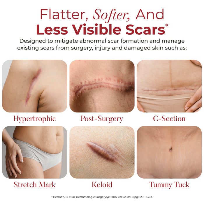 scar treatment tape
