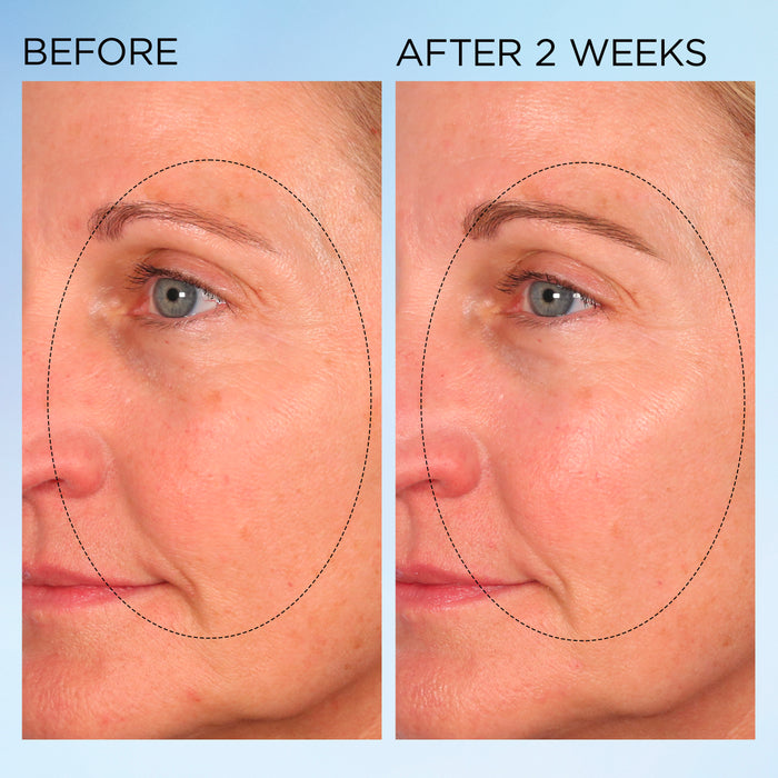 Elizabeth Arden UK Visible Brightening Clearly Radiant Spot Correcting Serum Capsules - before & after 2 weeks results