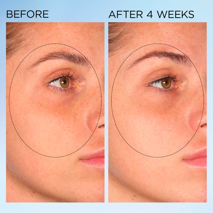 Elizabeth Arden UK Visible Brightening Clearly Radiant Spot Correcting Serum Capsules before & after 4 weeks results
